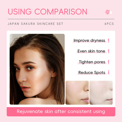 Cherry Blossom Skincare Set - Moist