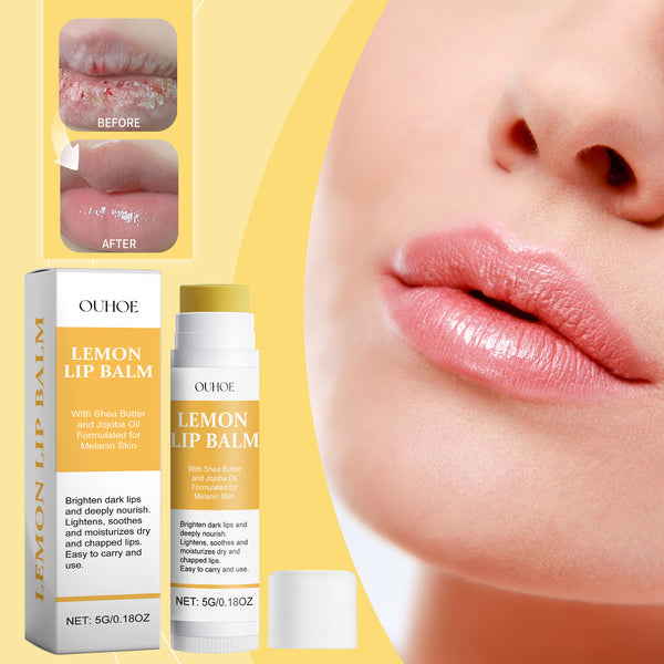 Lemon Ginger Lip Balm - Moist